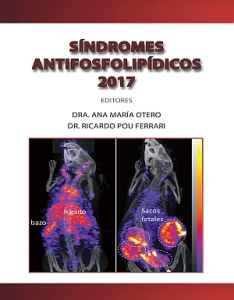 Libro Síndromes Antifosfolipídicos 2017 - Dra. Ana Maria Otero y Dr. Ricardo Pou Ferrari